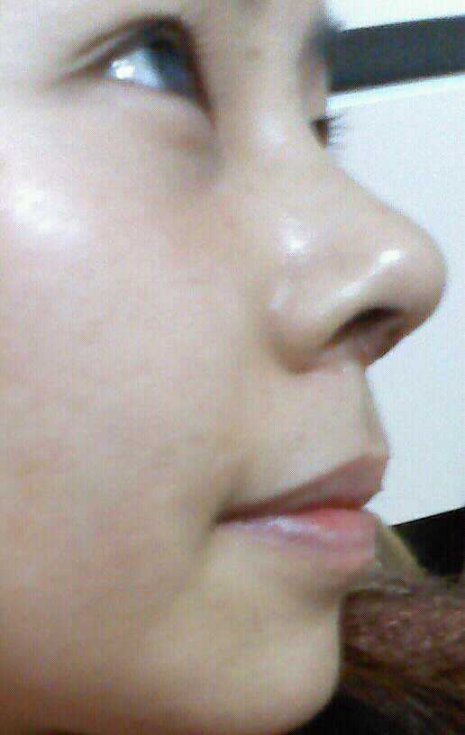 김0희님 후기 사진