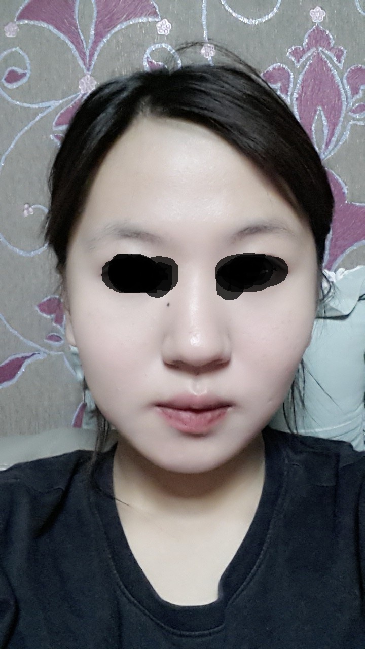 이고*님 후기 사진