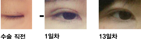 이0용님 후기 사진