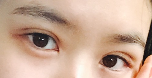 감사합니다원장님님 후기 사진