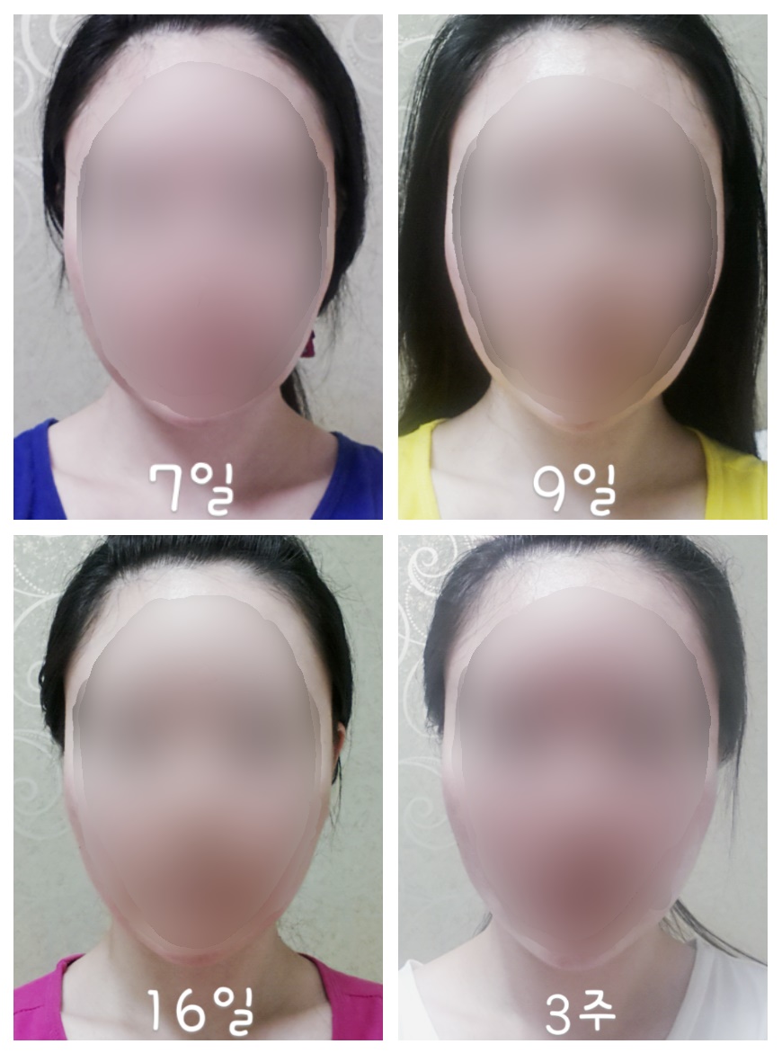 이0리님 후기 사진