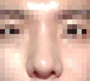 20대남자님 후기 사진