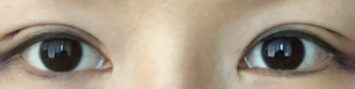 이0영님 후기 사진