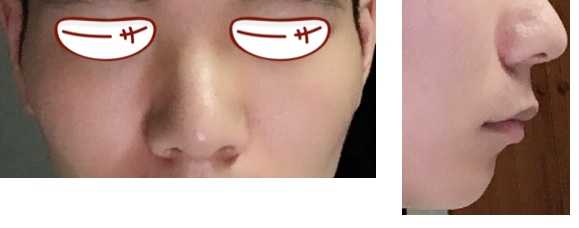 땡땡훈님 후기 사진