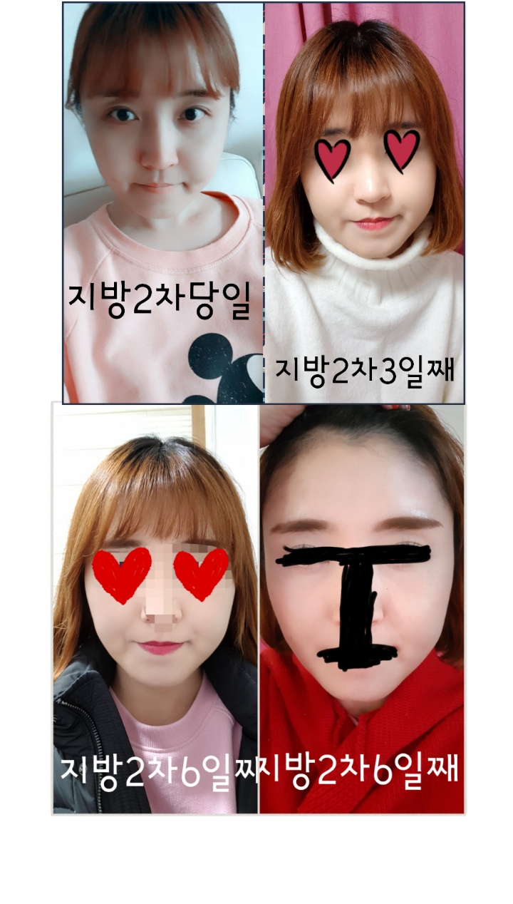 김0롬님 후기 사진