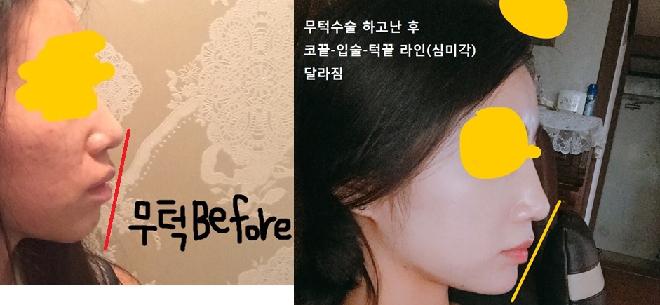 키키키님 후기 사진