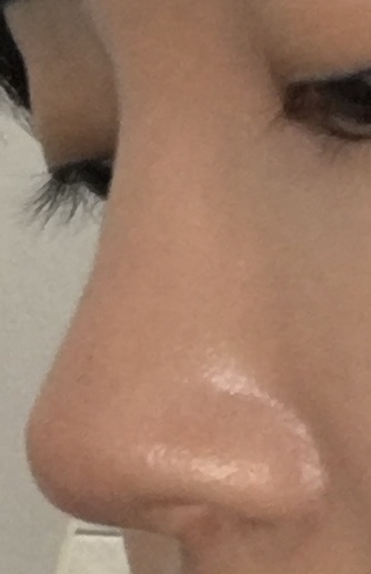 Zoe님 후기 사진