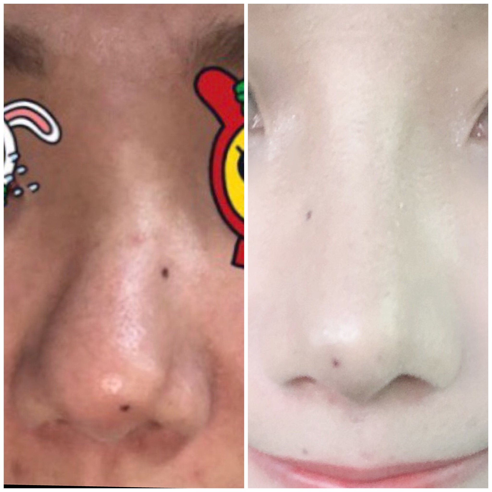 Eun님 후기 사진