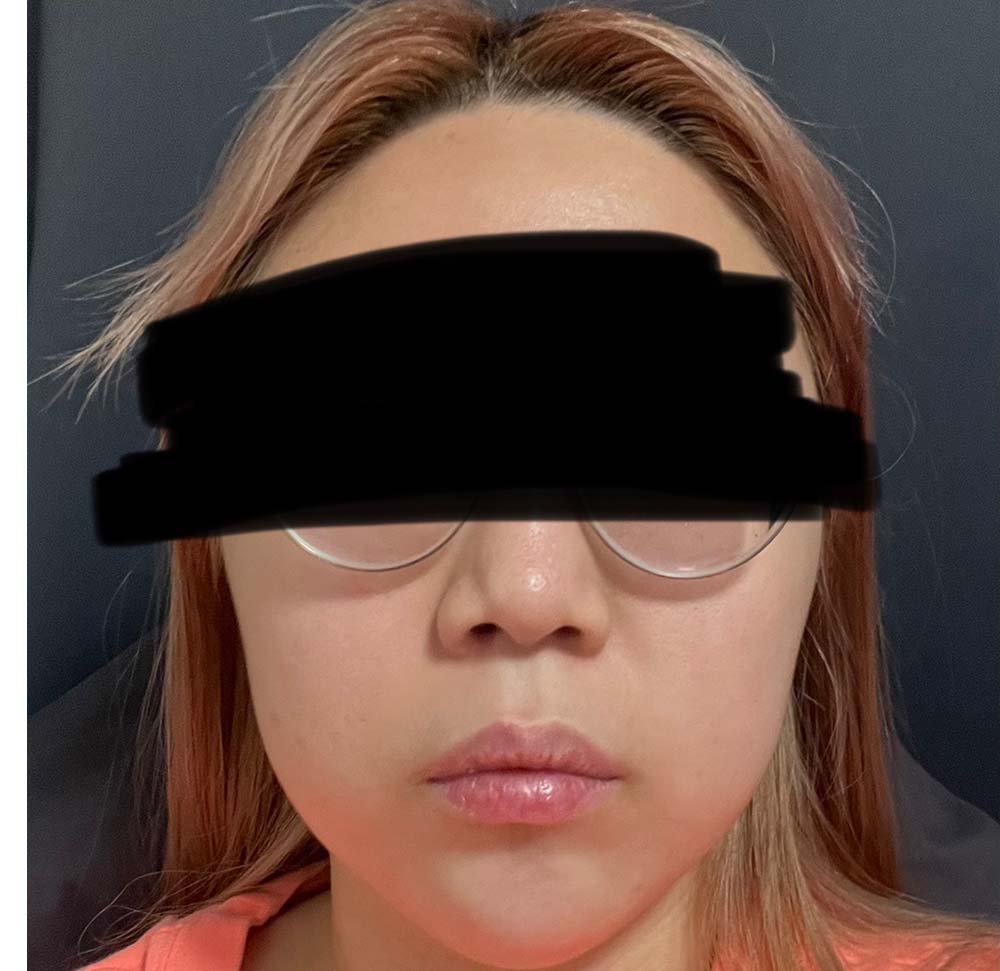 키키님 후기 사진