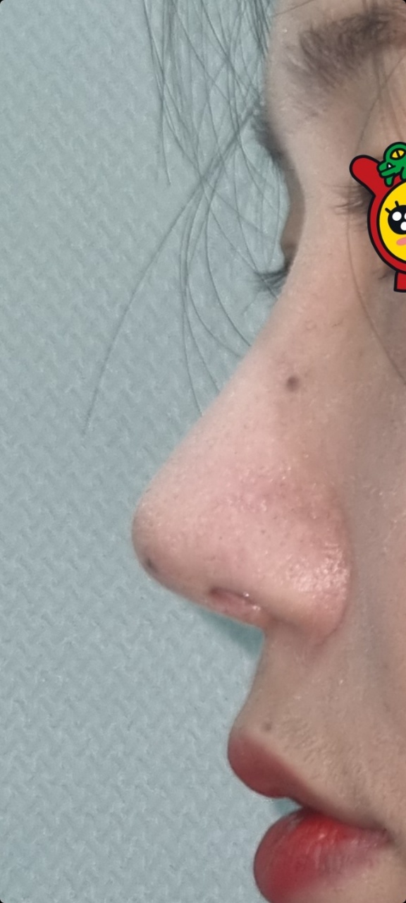 Eun님 후기 사진