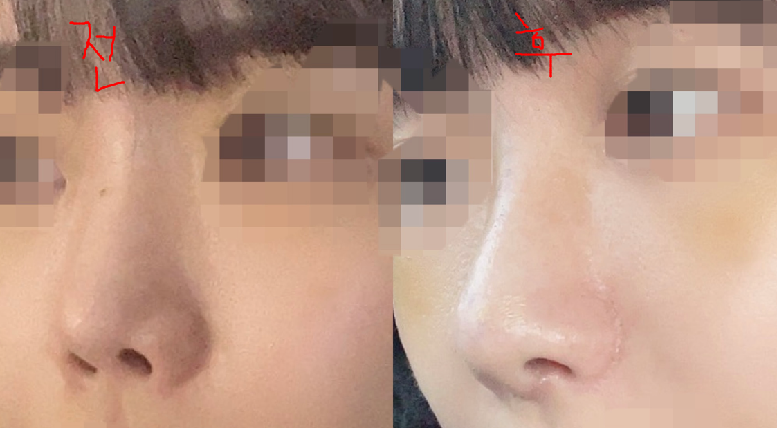min님 후기 사진