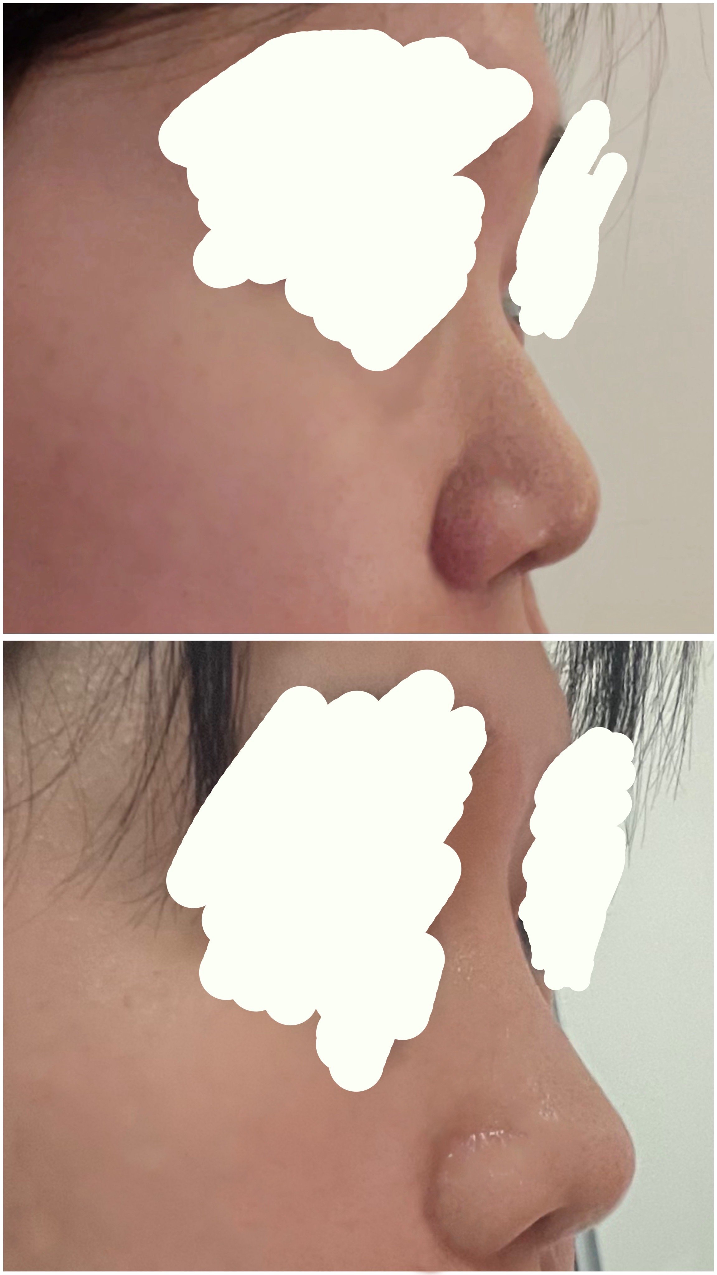 BBB님 후기 사진