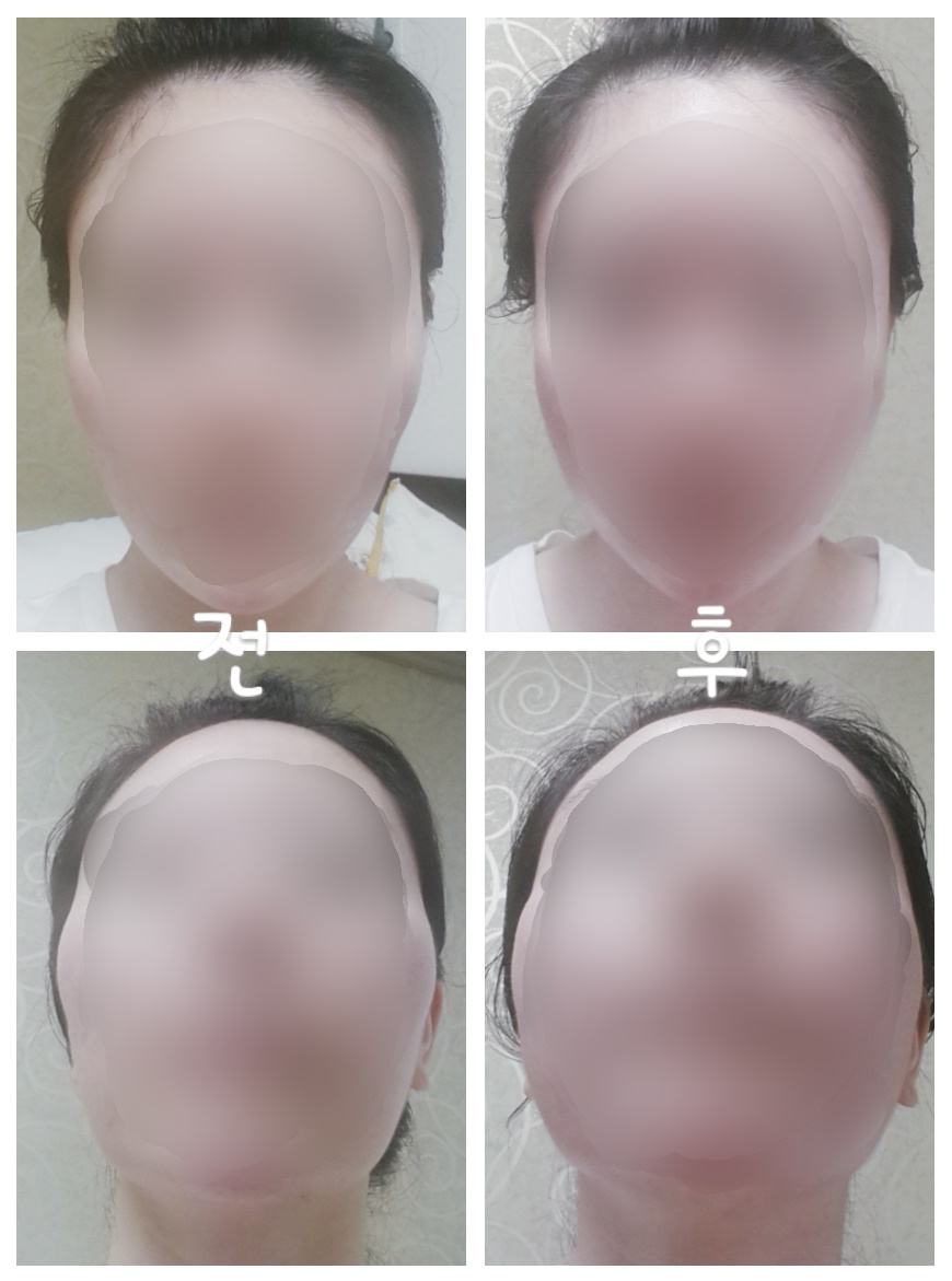 이0리님 후기 사진