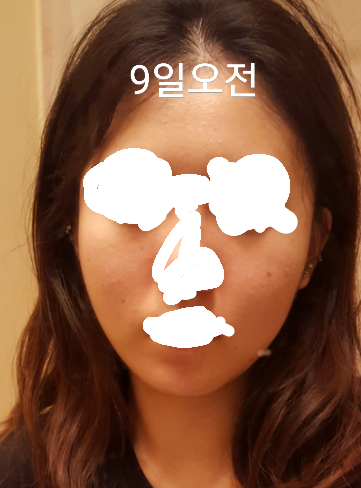 루루루님 후기 사진