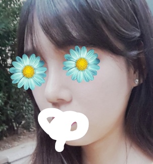 김0인님 후기 사진