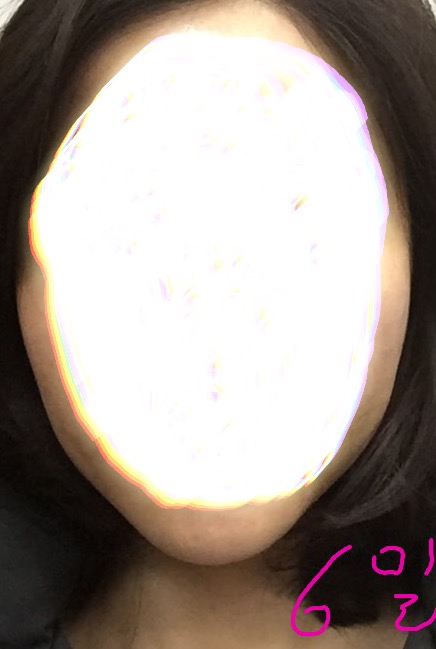 pink님 후기 사진