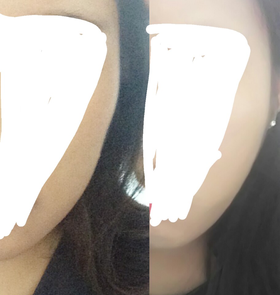 코코광대님 후기 사진