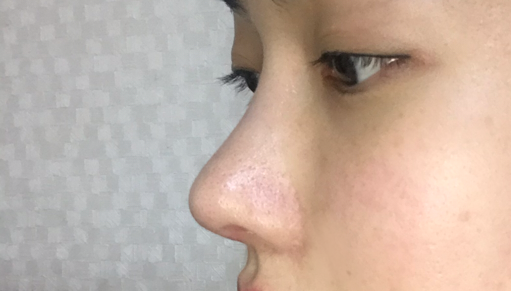 주주님 후기 사진