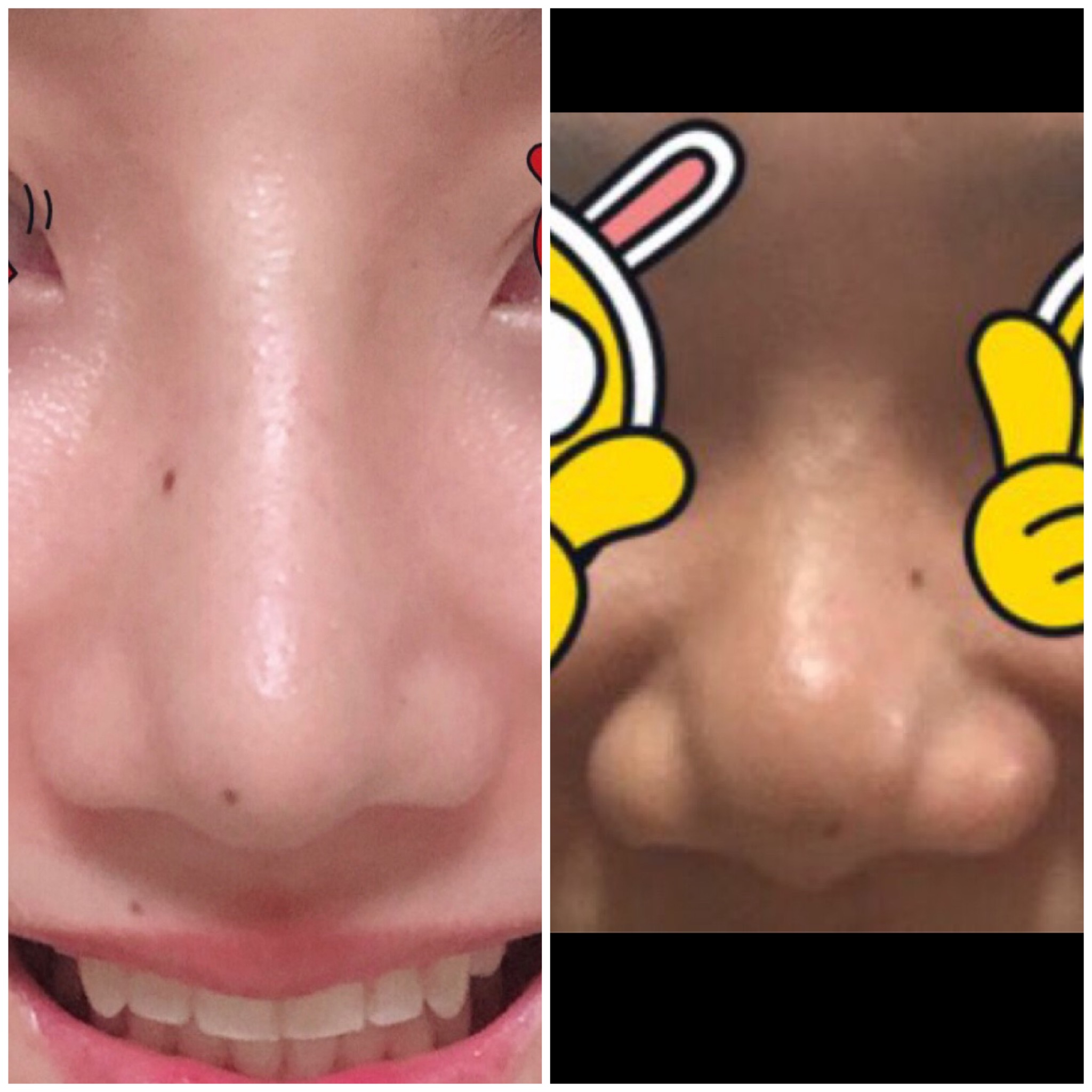 Eun님 후기 사진